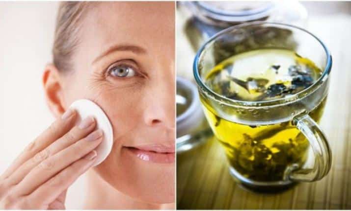 Green Tea for acne